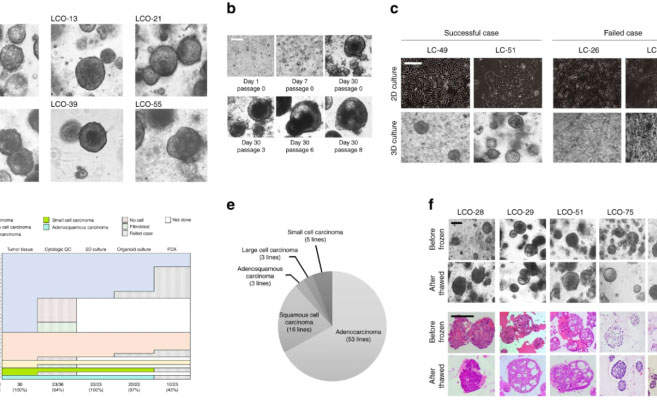 Quick Reading | Patient-derived Lung Cancer Organoids as In Vitro Cancer Models for Therapeutic Screening