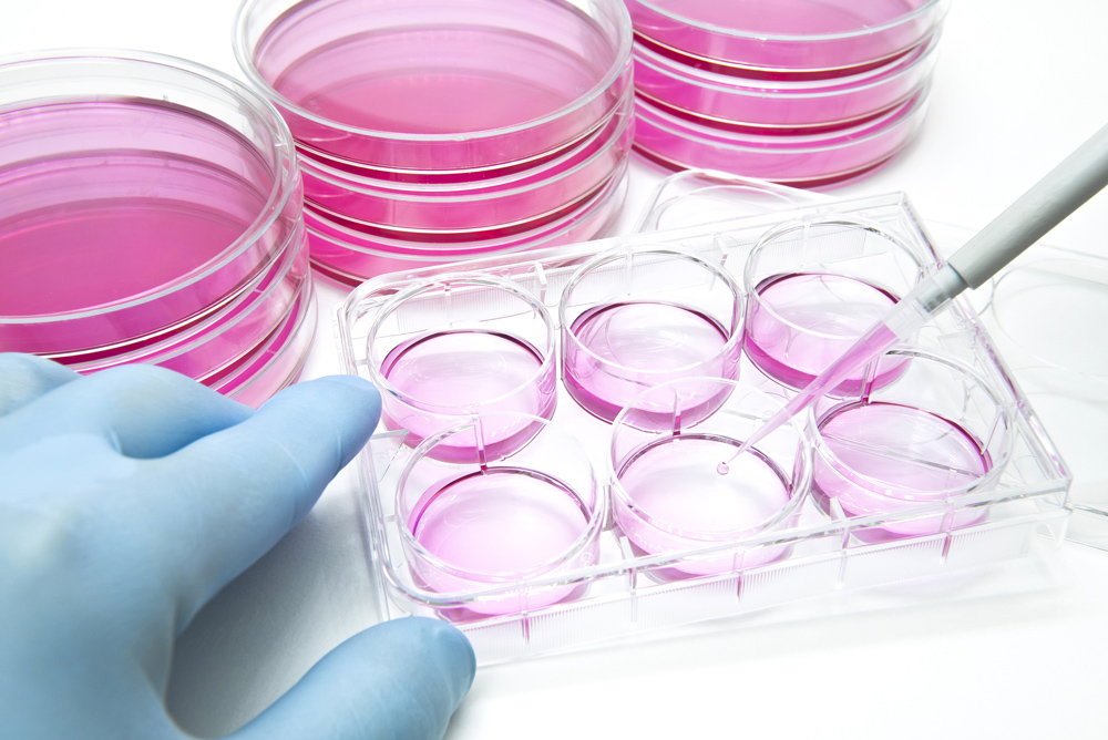 Mesenchymal Stromal Cells: A Comprehensive Guide to Research and Therapy