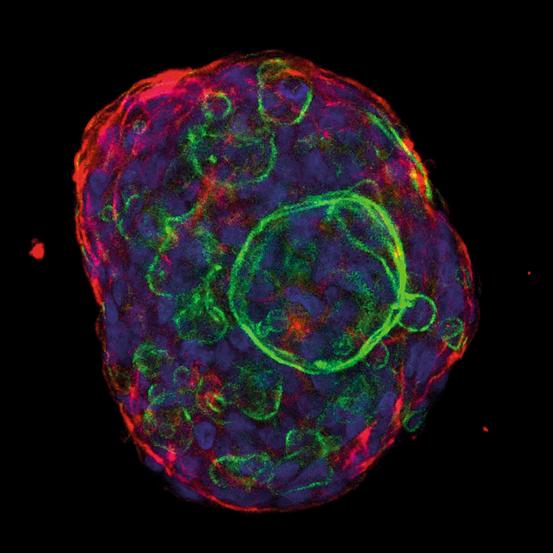 Gastric Organoid Culture: Building a More Defined and Reproducible 3D Culture System